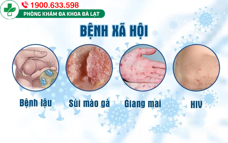 Các căn bệnh xã hội và triệu chứng thường gặp